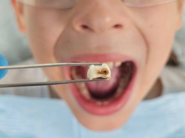 Best Emergency Gum Pain Relief  in West Milton, PA