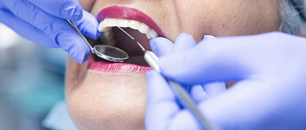 Best Dentist for Tooth Abscess  in West Milton, PA